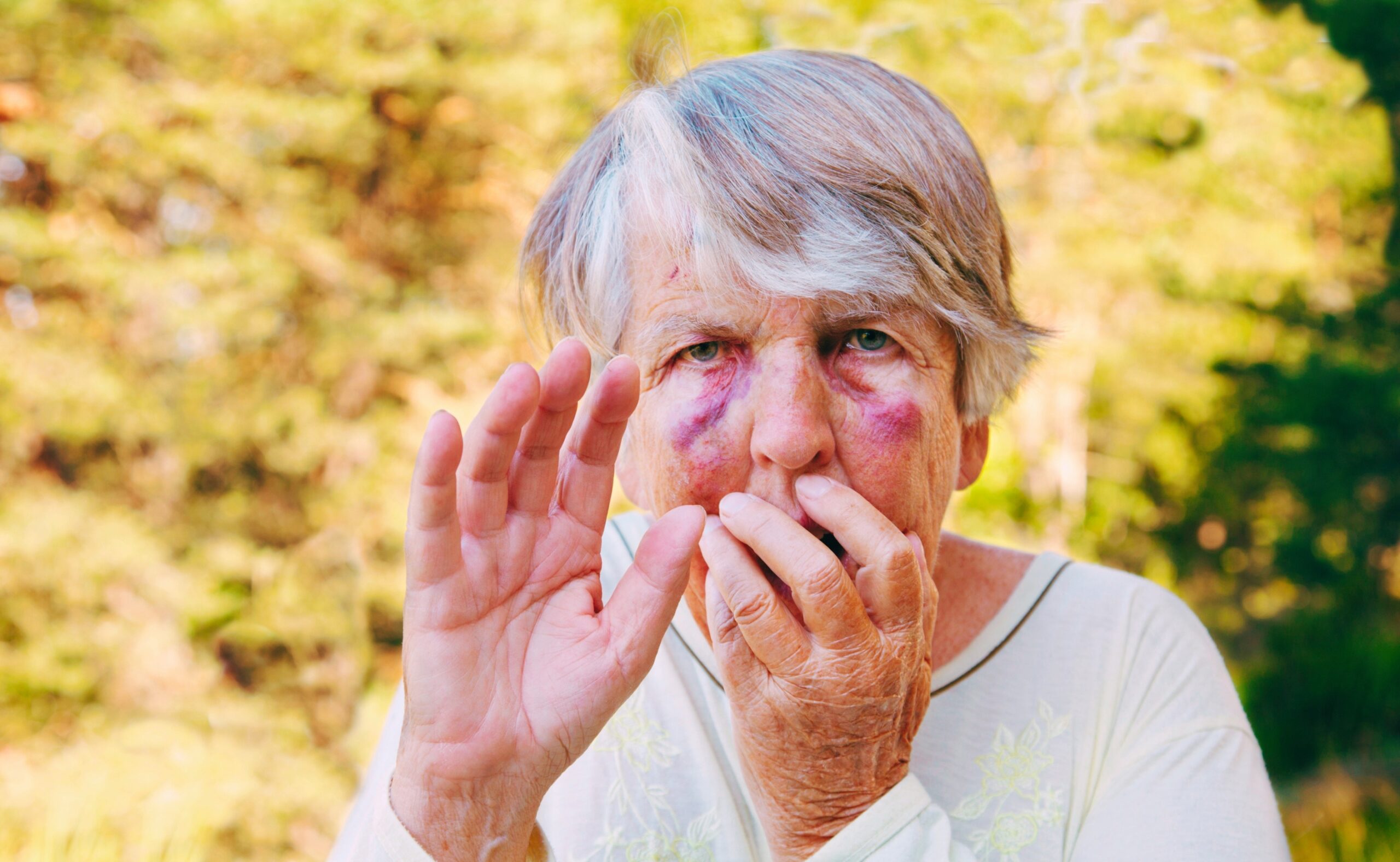 Scared and maltreated senior woman with big bruises