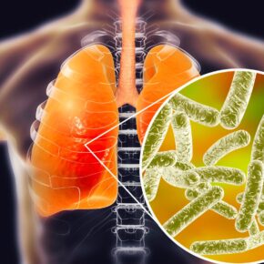 Legionnaires' disease, conceptual computer illustration. Legionella pneumophila bacteria are the cause of Legionnaires' disease. These bacilli (rod-shaped bacteria) are Gram-negative. L. pneumophila was identified as a pathogen after a mysterious outbreak.